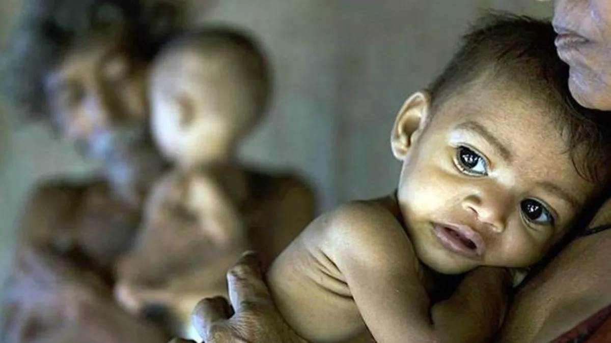 https://www.jagranimages.com/images/newimg/01092023/01_09_2023-malnourished_23518731.jpg