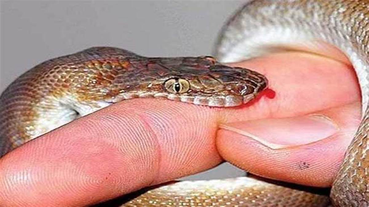 https://www.jagranimages.com/images/newimg/01092024/01_09_2024-snake_bite_23789419_214927289.jpg