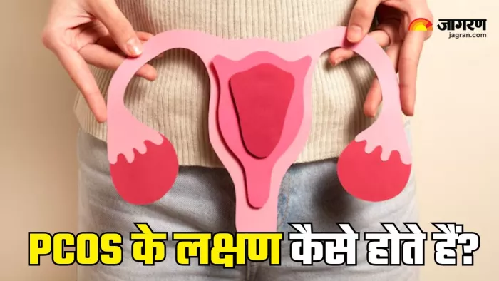 बेहद सामान्य होते हैं PCOS के लक्षण (Picture Courtesy: Freepik)