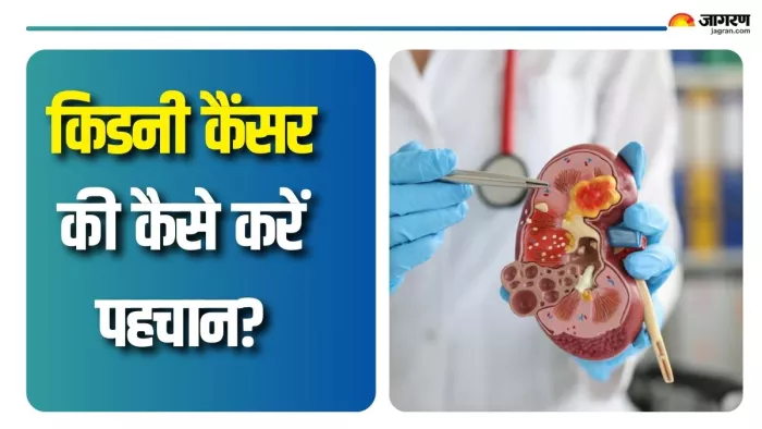 किडनी कैंसर के इन लक्षणों से रहें सावधान (Picture Courtesy: Freepik)