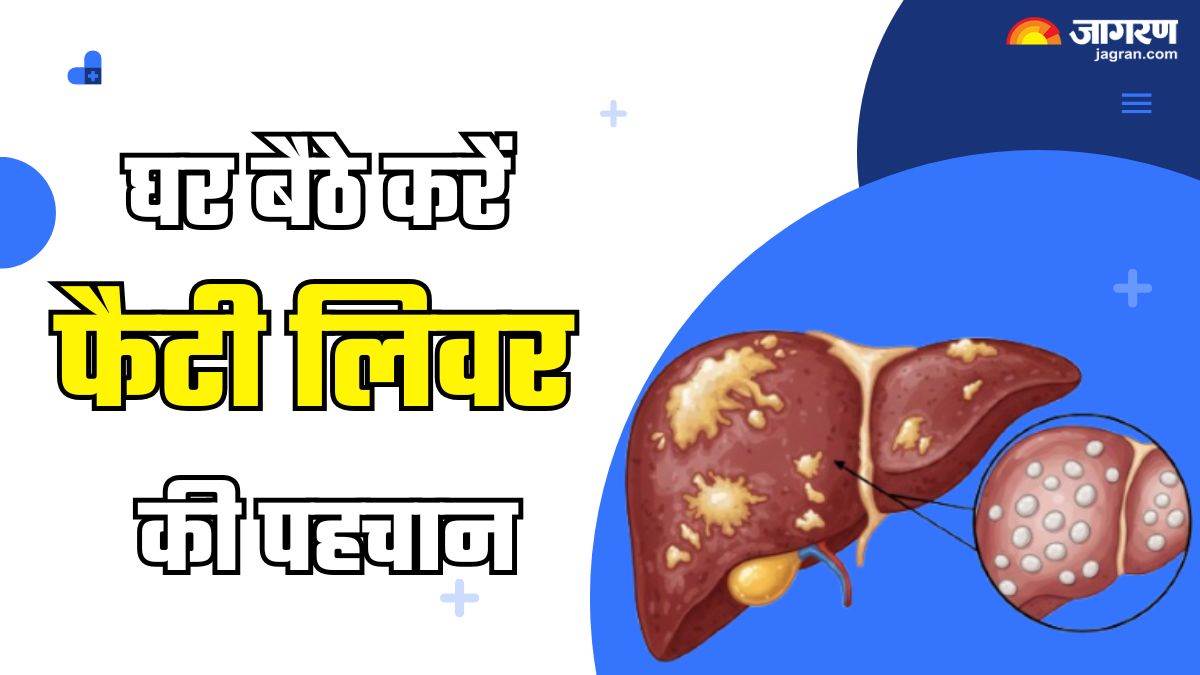 doctors warning 7 early symptoms of fatty liver you can identify at home