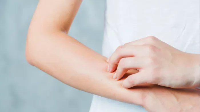 Skin Dryness Remedies: स्किन ड्रायनेस दूर करने के उपाय