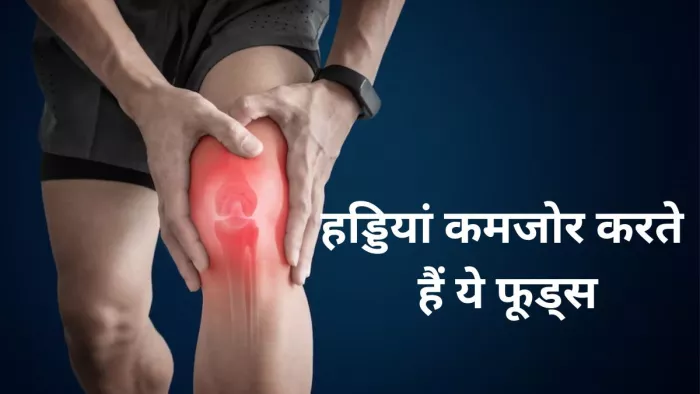 आपकी हड्डियों को कमजोर बनाते हैं ये फूड्स