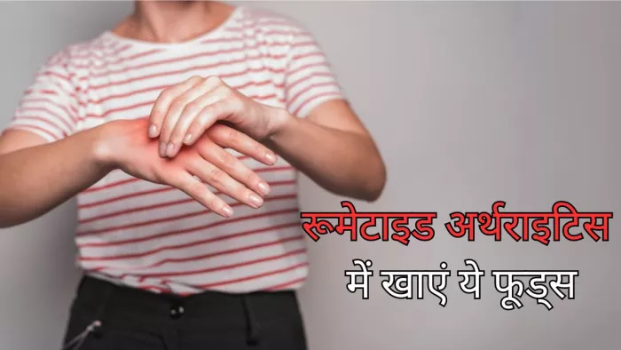 इन फूड्स आइटम्स से करें Rheumatoid Arthritis को कंट्रोल