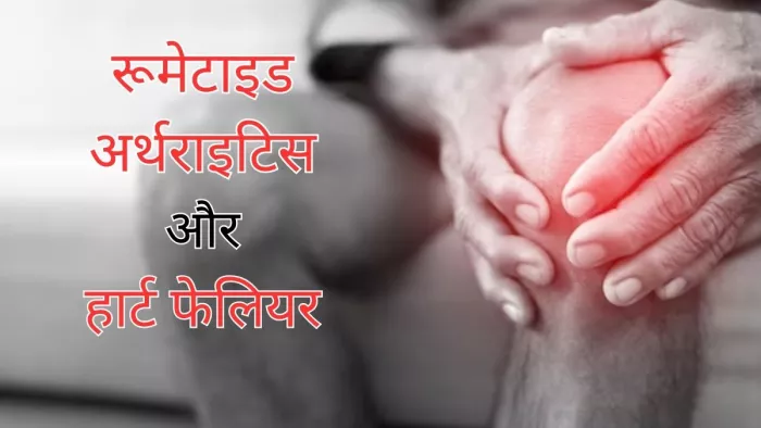 रूमेटाइड अर्थराइटिस की वजह से बढ़ सकता है हार्ट फेलियर का खतरा