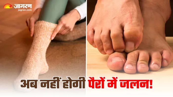 सर्दियों में मोजे पहनने पर नहीं होगी पैरों में जलन, अपनाएं 5 घरेलू उपाय (Image Source: Freepik)