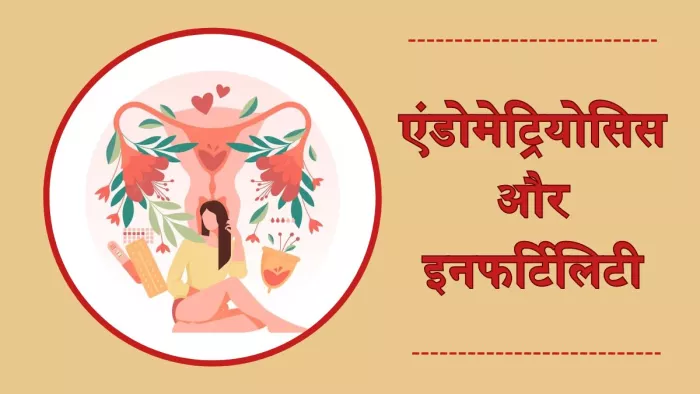 एंडोमेट्रियोसिस की वजह से कई महिलाओं में इनफर्टिलिटी की समस्या भी हो सकती है।