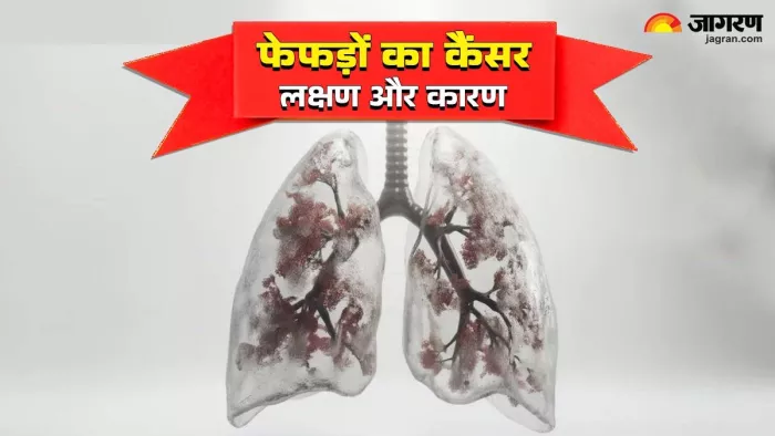 कैंसर के मरीजों को लेकर चौंकाने वाले तथ्य सामने आए। फाइल फोटो