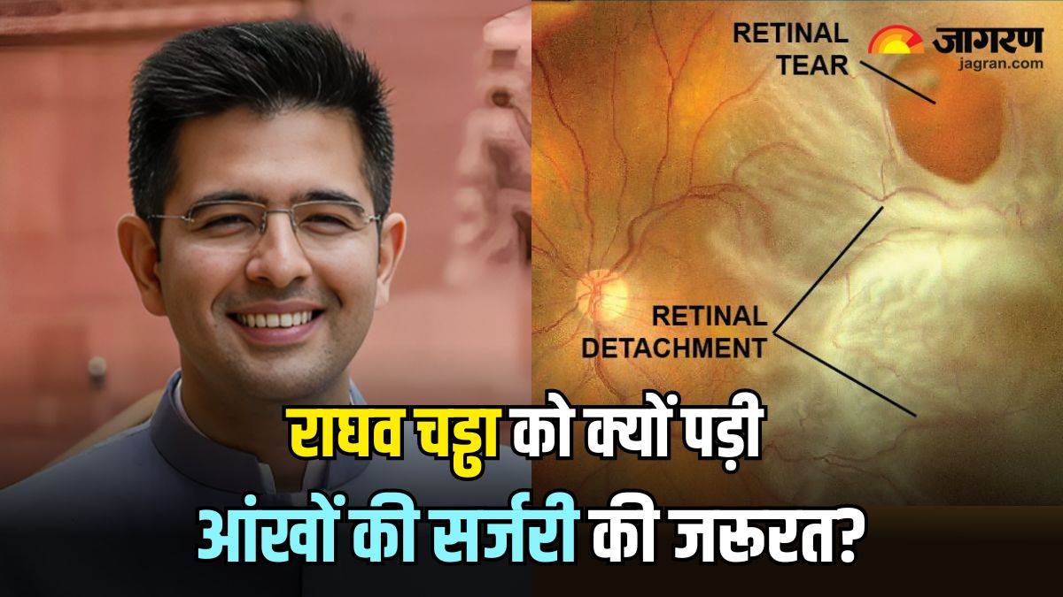 what is retinal detachment why raghav chadha needed vitrectomy know its symptoms and causes in hindi
