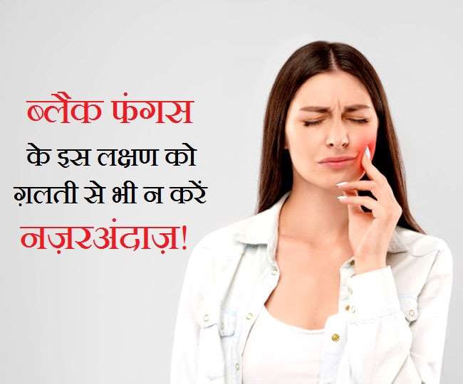 Black Fungus Symptom Recently Recovered From Covid Then Be Aware Of These 5 Symptoms Of Dental Infection