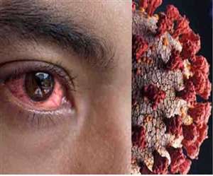 ब्‍लैक फंगस हरियाणा में लगातार फैल रहा है। (सांकेतिक फोटो)