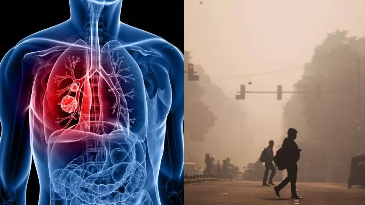 Lung Cancer: इस गलती से होता है फेफड़े का कैंसर, बनता है 85 प्रतिशत मौत का कारण;  बस एक ही है बचाव का उपाय