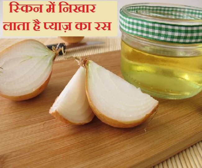 Onion Juice Benefits for Skin स्किन की कई समस्याओं का उपचार करता है