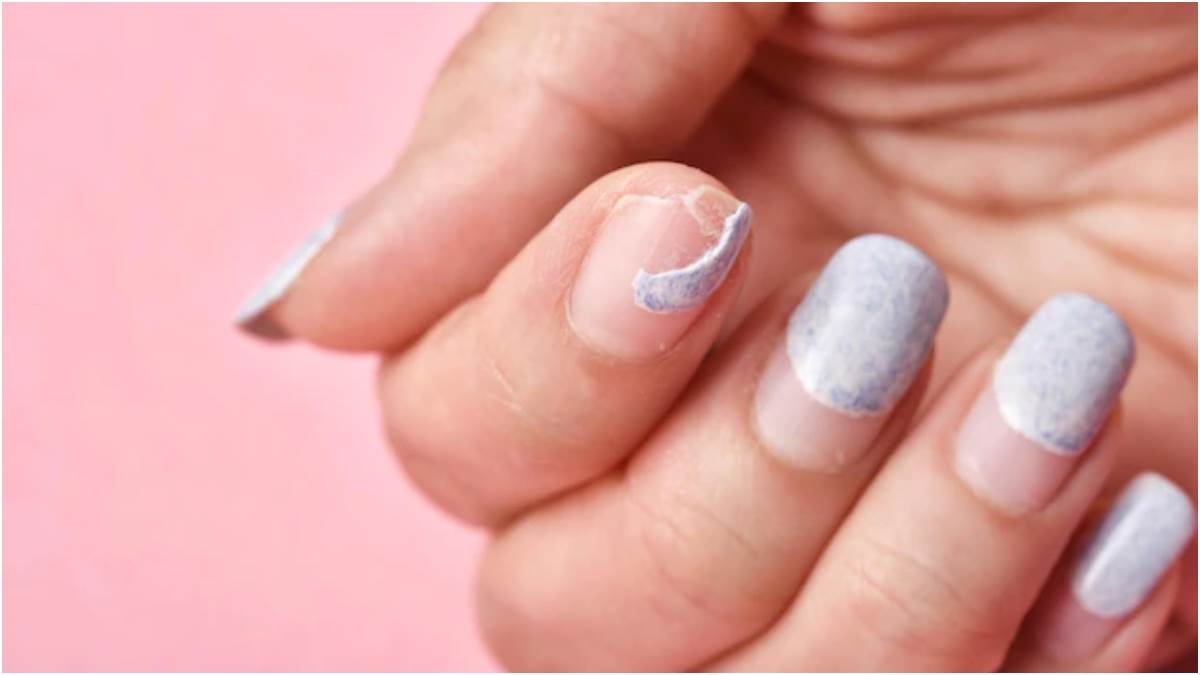 Brittle Nails: क्या आपके भी नाखून आसानी से टूट जाते हैं, तो सिर्फ करें ये 5  काम - Brittle Nails Causes, Treatment, and Prevention