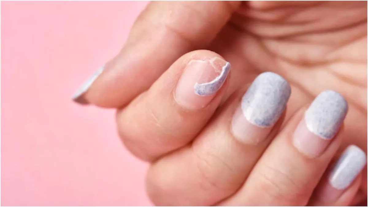 Brittle Nails क्या आपके भी नाखून आसानी से टूट जाते हैं, तो सिर्फ करें