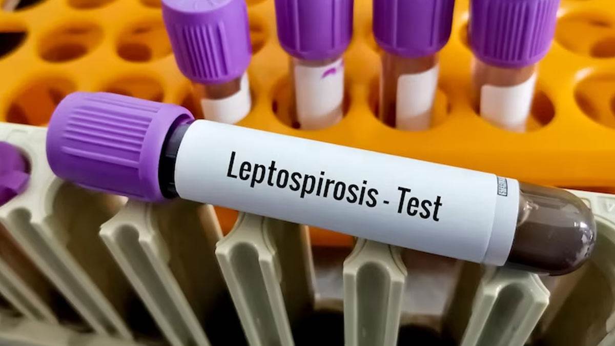 this is an effective way to reduce the risk of leptospirosis