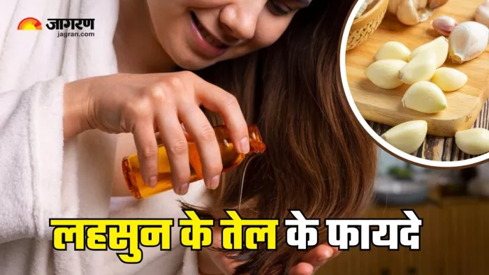 बालों के लिए फायदेमंद है लहसुन का तेल (Picture Courtesy: Freepik)