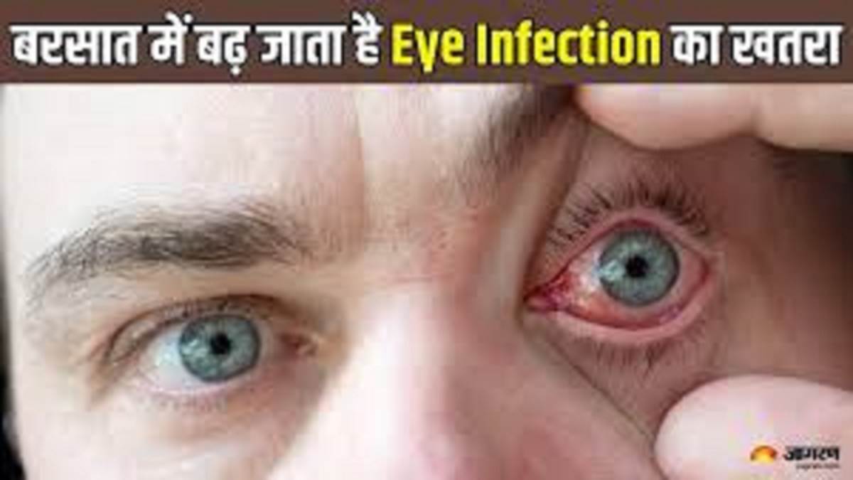 https://www.jagranimages.com/images/newimg/02082025/02_08_2025-eye_infection_24001736.jpg