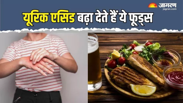 डिनर में इन फूड्स से करें परहेज, कंट्रोल होगा आपका यूरिक एसिड (Picture Credit- Freepik)