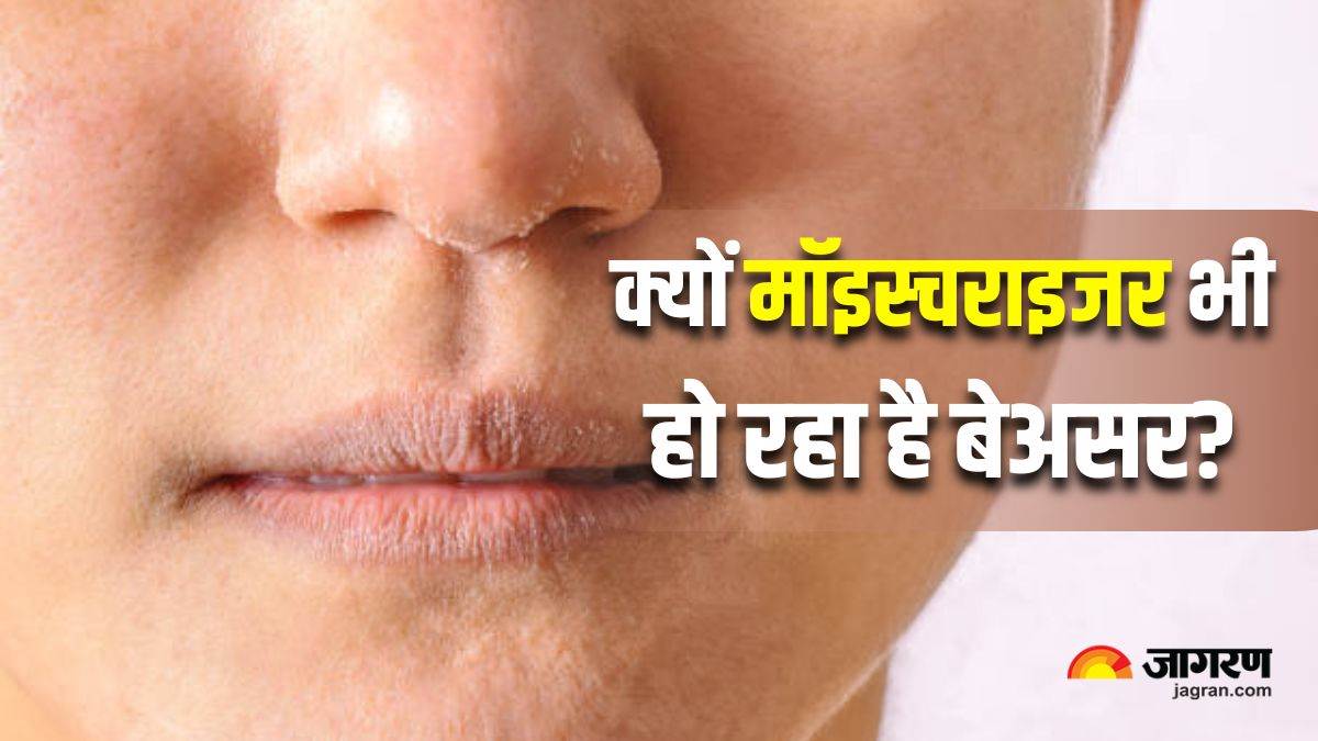 https://www.jagranimages.com/images/newimg/02092025/02_09_2025-dry_skin_even_with_moisturizer_24033145.jpg