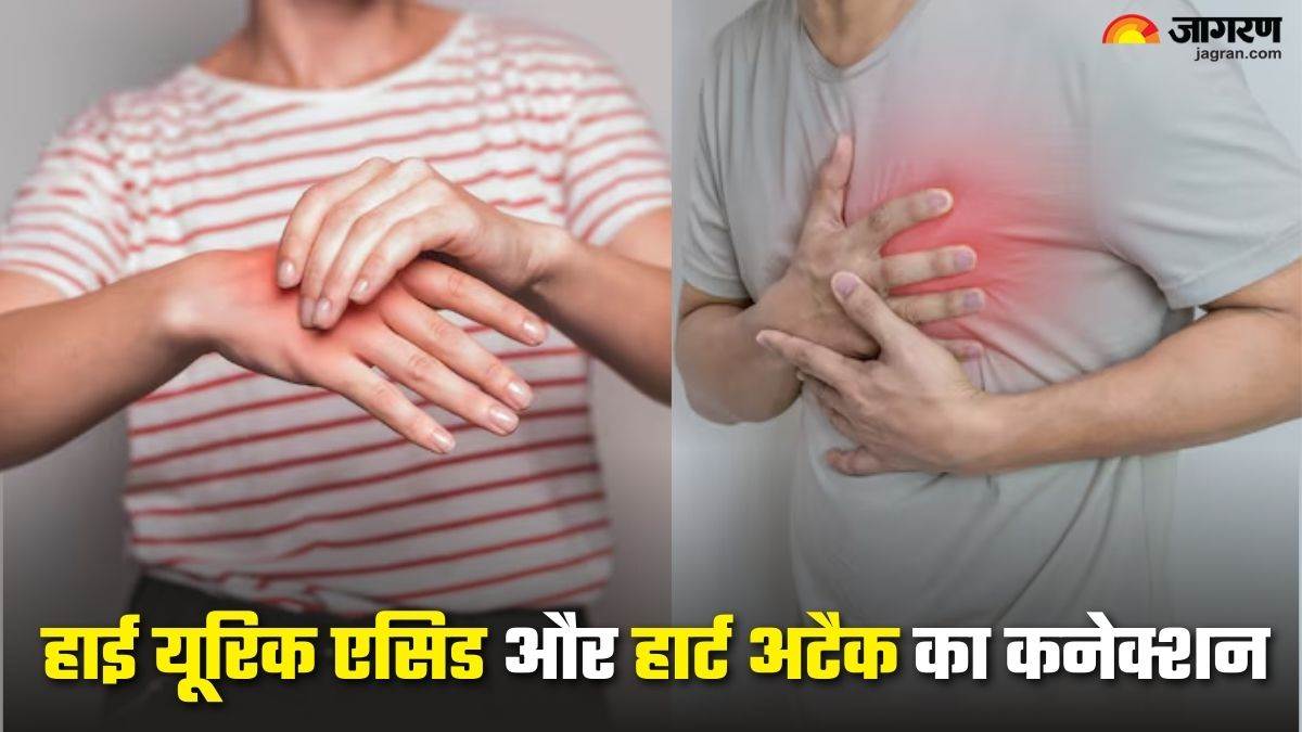 https://www.jagranimages.com/images/newimg/02092025/02_09_2025-high_uric_acid_and_heart_attack_24033313.jpg