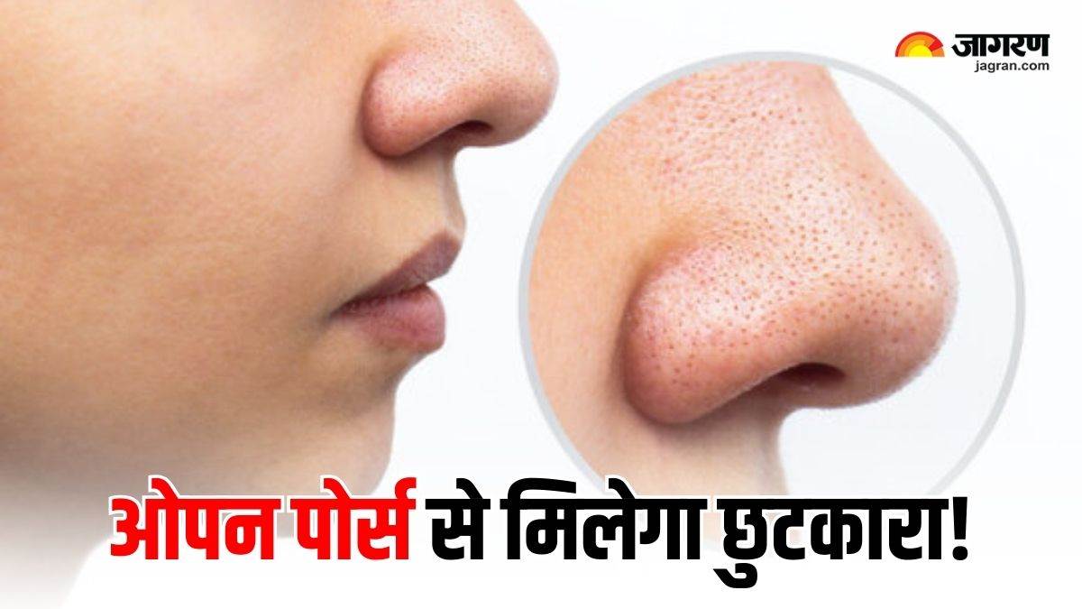 https://www.jagranimages.com/images/newimg/02092025/02_09_2025-how_to_reduce_open_pores_24032990.jpg