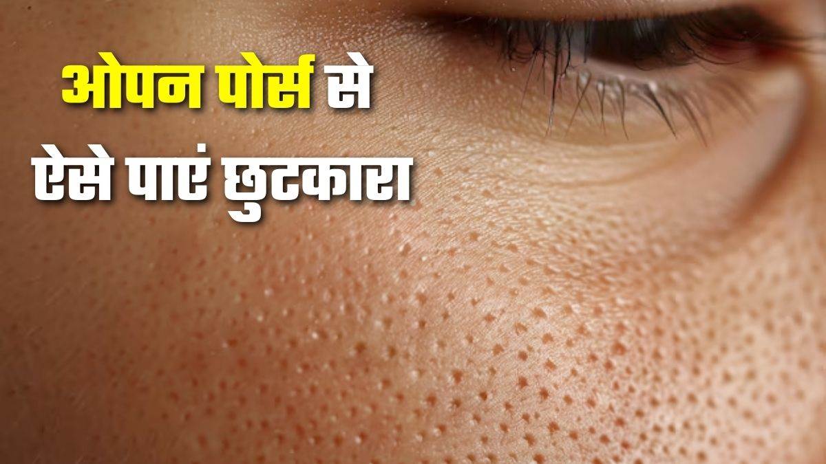 https://www.jagranimages.com/images/newimg/02092025/02_09_2025-open_pores_24032990_195840277.jpg