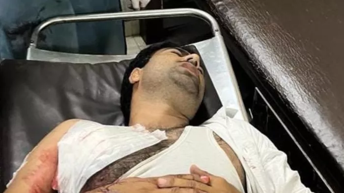 Ghaziabad Crime: चूना भट्टी कॉलोनी में जमीनी विवाद में युवक के सीने में मारी गोली, भाई पर आरोप