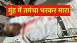 बीआरडी मेडिकल कालेज में भर्ती सर्राफ की स्थिति गंभीर है।