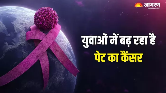 डॉ. से समझें Stomach Cancer से बचाव के आसान तरीके (Picture Courtesy: Freepik)
