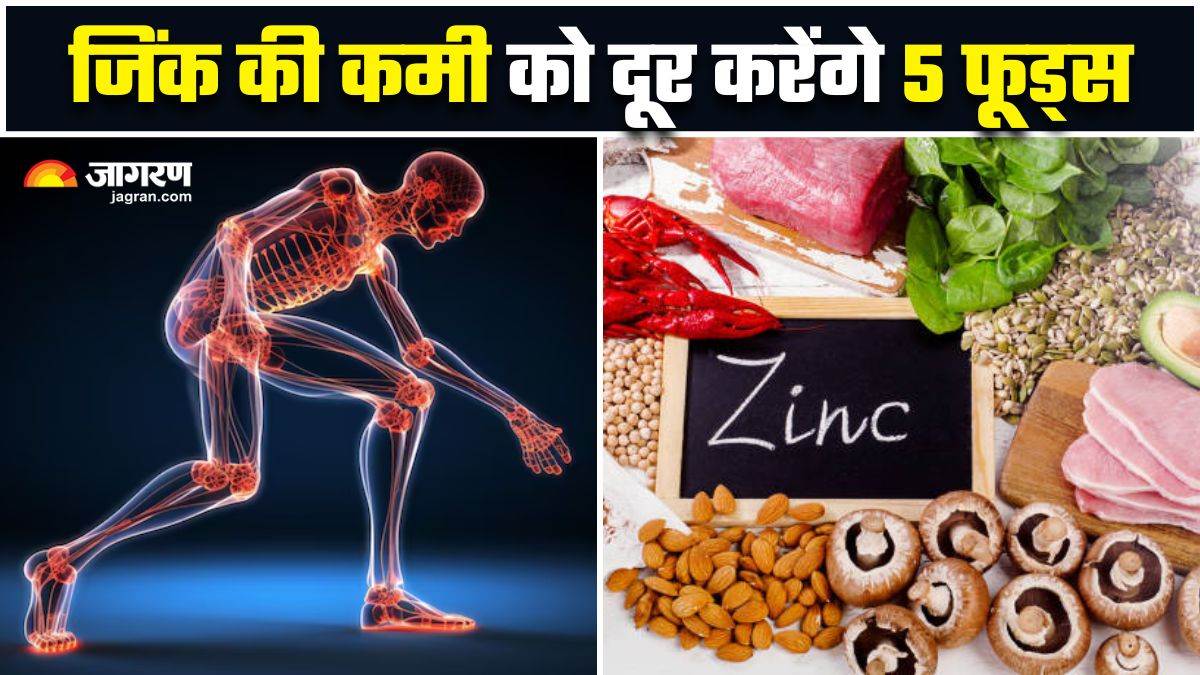 https://www.jagranimages.com/images/newimg/03022025/03_02_2025-zinc_deficiency_23877820.jpg
