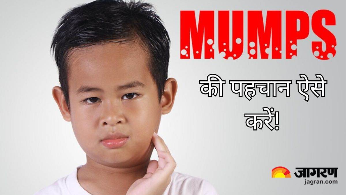 https://www.jagranimages.com/images/newimg/03052024/03_05_2024-mumps-symptoms_23710124_152447915.jpg