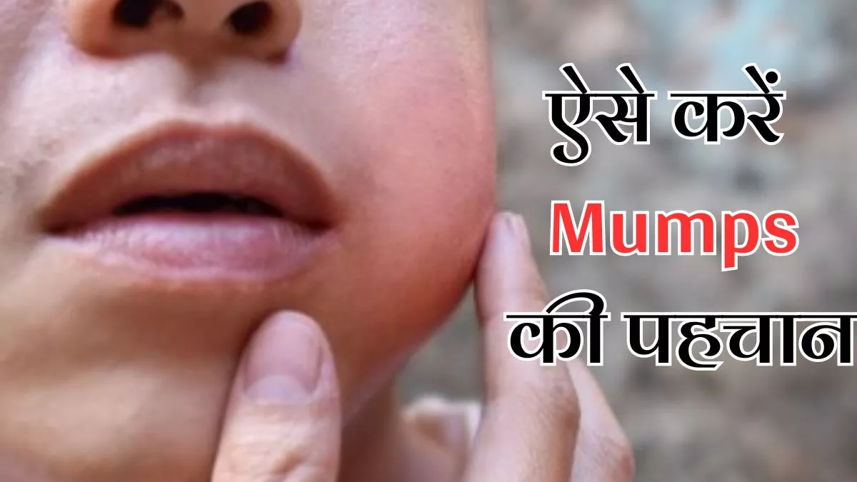 राजधानी में तेजी से बढ़ रहा Mumps का प्रकोप, इन लक्षणों से इसकी पहचान कर रखें अपनों का ख्याल