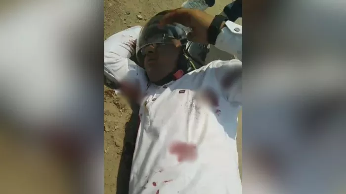 बदमाशों ने अधिवक्ता को दिनदहाड़े मारी गोली, हालत गंभीर। (तस्वीर जागरण)