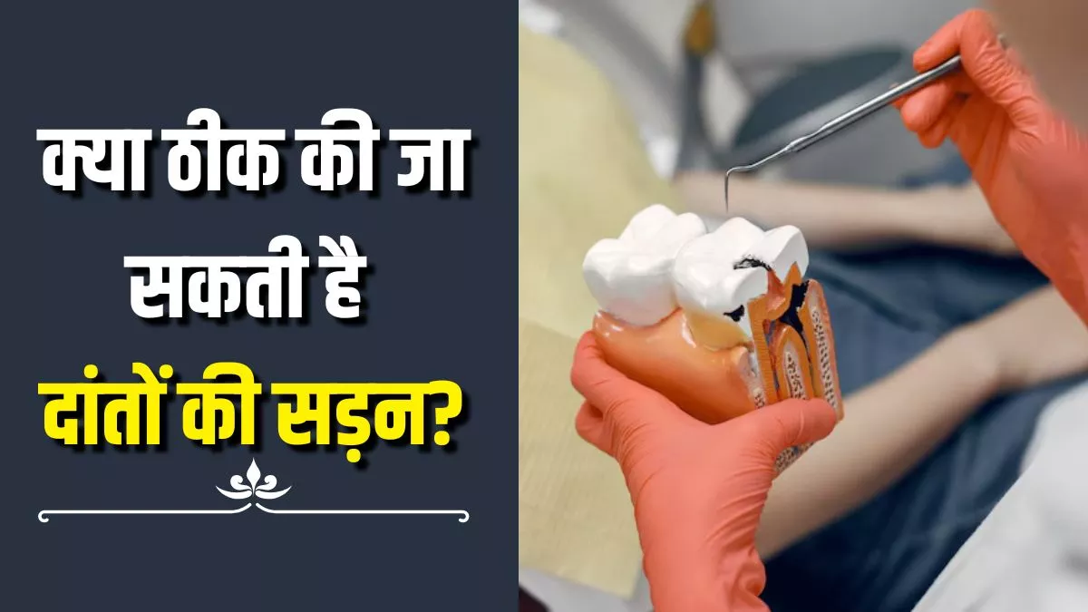 अगर दांतों में लग गए हैं कीड़े, तो क्या इसे ठीक किया जा सकता है? Tooth Decay रोकने के लिए क्या करें