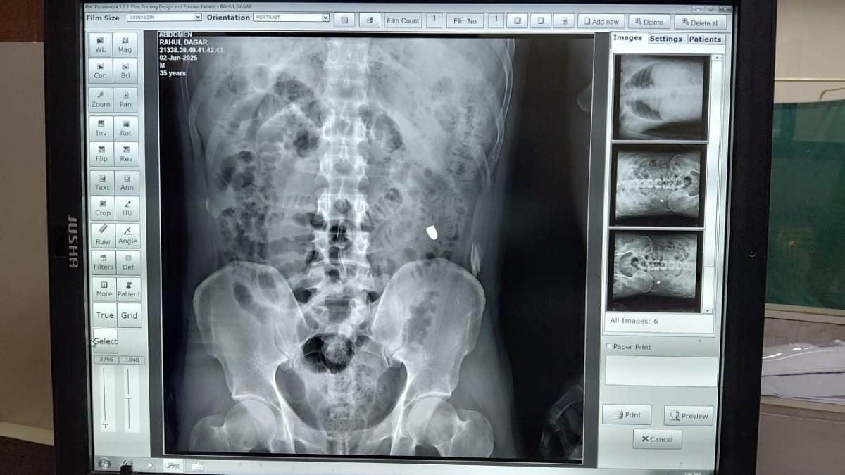 ncr ghaziabad news rahul dagar murder postmortem reveals details