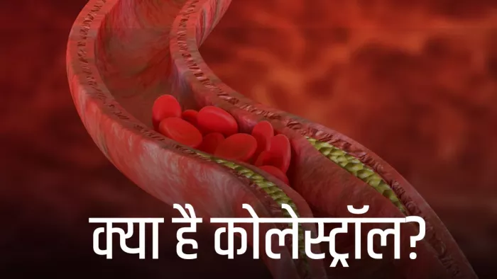 क्या है कोलेस्ट्रॉल और क्यों है ये जरूरी? (Picture Credit- Freepik)