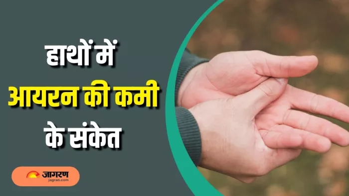 कैसे पहचाने आयरन की कमी के लक्षण (Picture Courtesy: Freepik)