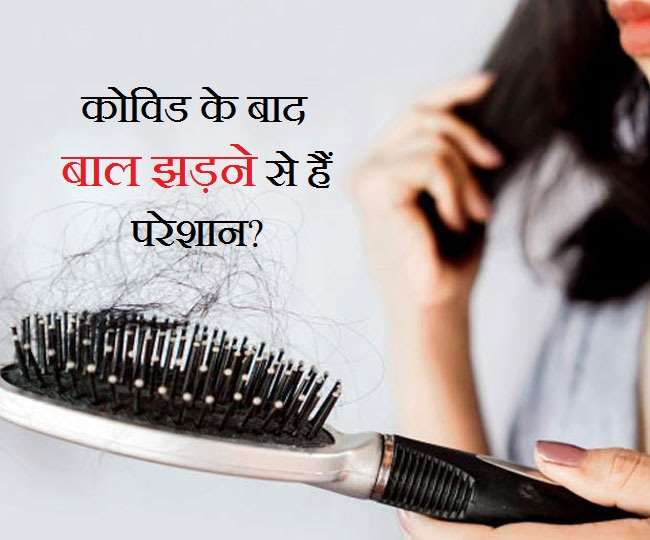 Post Covid Hair Fall 5 Best Home Remedies For Hair Fall Vimarsana Post Covid Hair Fall 5 Best Home Remedies For Hair Fall Vimarsana