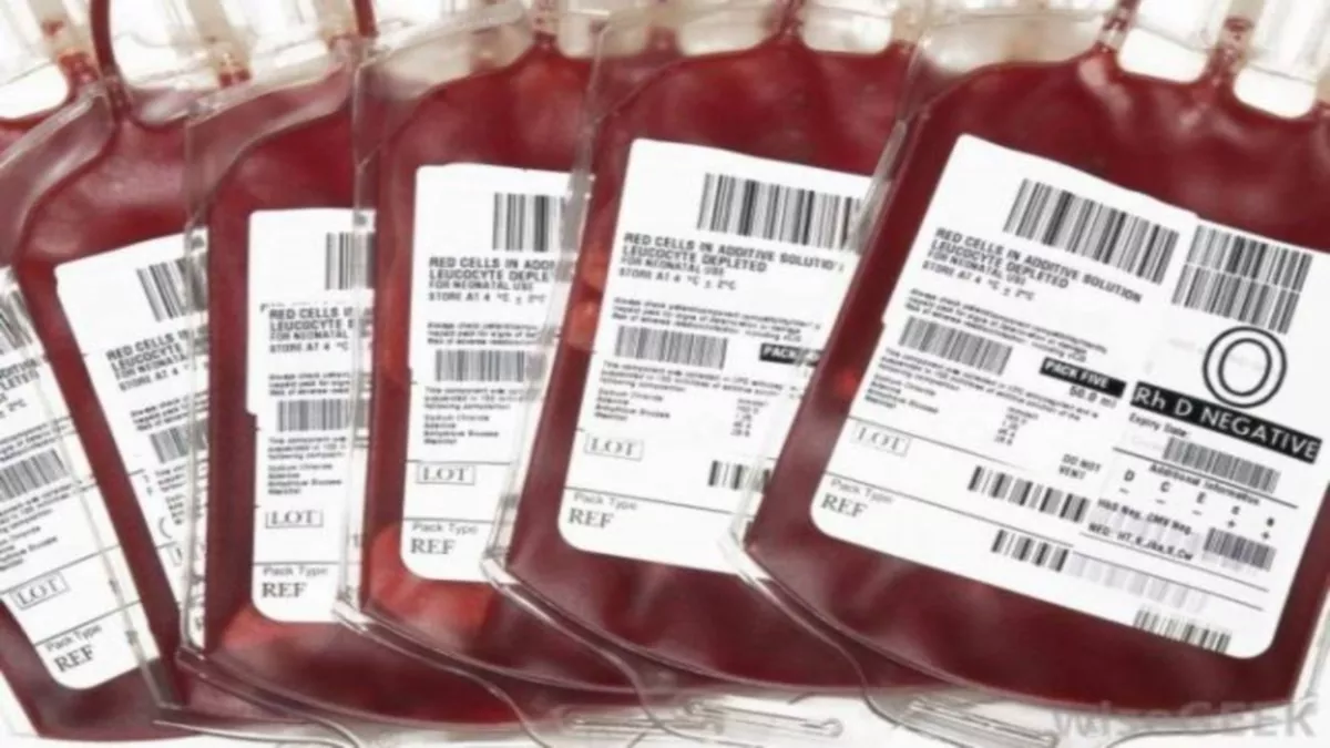 Blood Bank: प्रयागराज में बिकता है खून... 5000-8000 रुपये दीजिए और एक यूनिट ब्‍लड ले जाइए