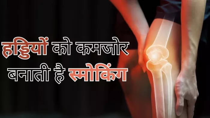 हड्डियों की खोखला करती हैं आपकी ये आदतें