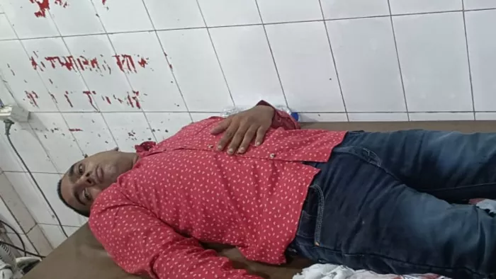 पुलिस की गोली लगने से घायल बदमाश।