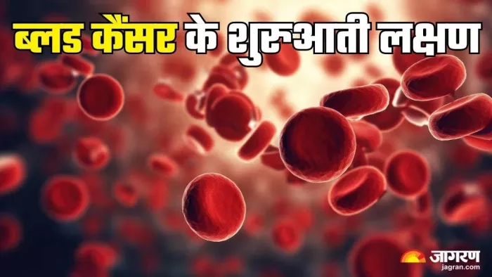 ब्लड कैंसर इन शुरुआती लक्षणों से करें पहचान (Picture Credit- Freepik)