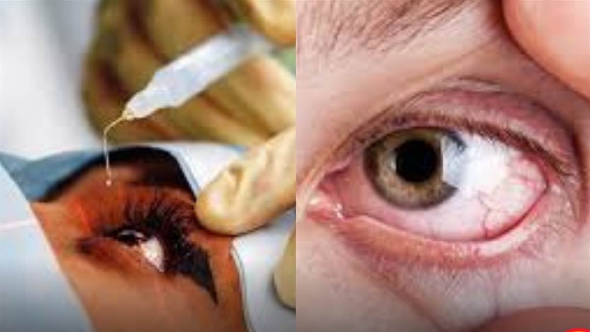 https://www.jagranimages.com/images/newimg/03092025/03_09_2025-eye_24034139.jpg