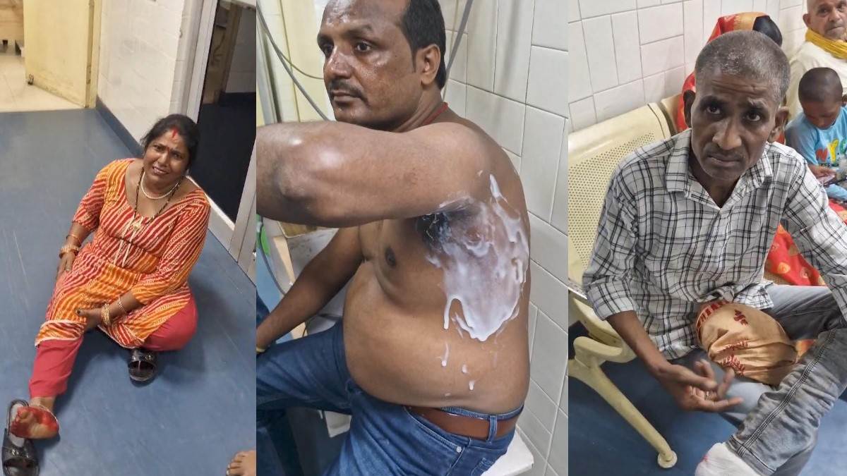 sonbhadra firework mishap four injured at renukoot dussehra event