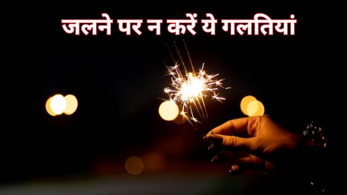 diwali 2023 first aids tips for burns during diwali