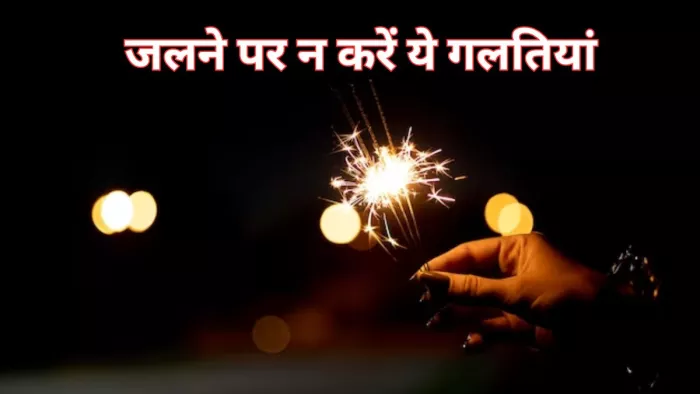 दिवाली पर पटाखों से जलने पर ऐसे करें फर्स्ट एड