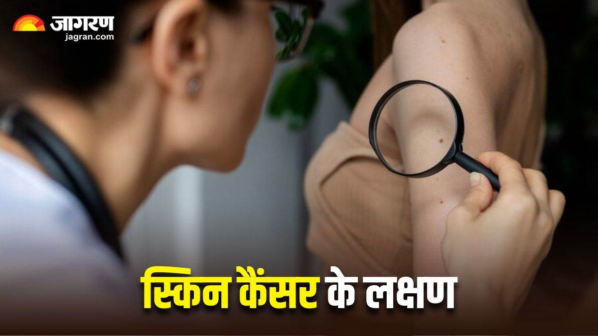 5 signs that appear on the skin that indicate skin cancer be careful if you take it lightly