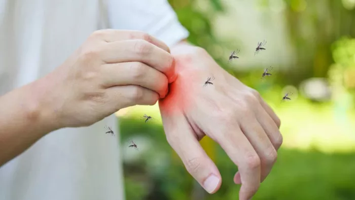 mosquitoes home remedies मच्छरों को भगाने के लिए अपनाएं ये घरेलू उपाय