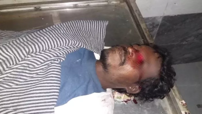 MP News: सागर के जिला अस्पताल में बदइंतजामी का आलम, पोस्टमार्टम कक्ष में रखे शव की आंख कुतर गए चूहे
